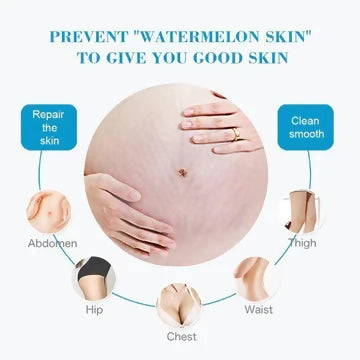 Aichun Beauty Anti-stretch Mark Cream