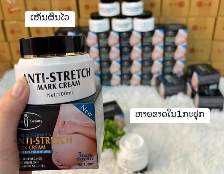 Aichun Beauty Anti Stretch Stretch Marks Removal Cream