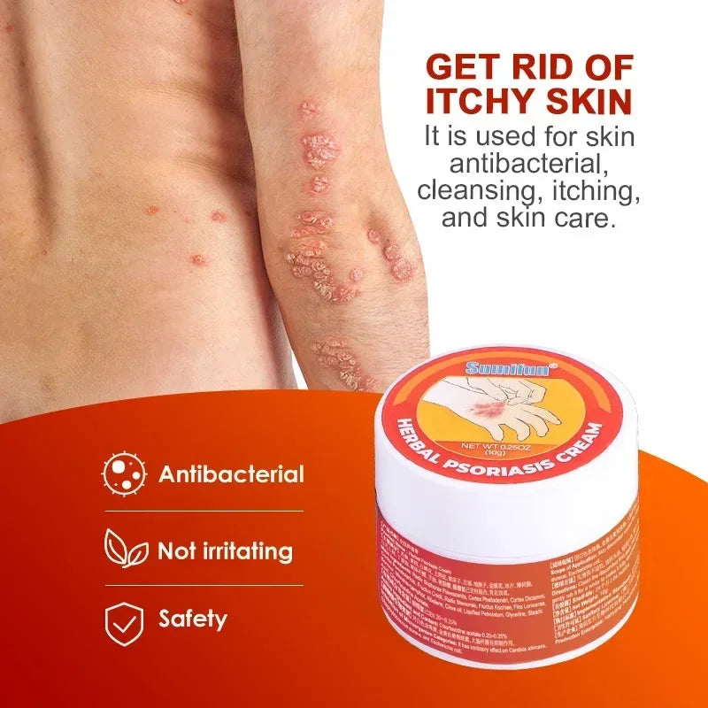 Medical Psoriasis Cream Dermatitis Eczematoid Ointment Antibacterial Anti Itching Rash Urticaria Plaster Skin Care Cream