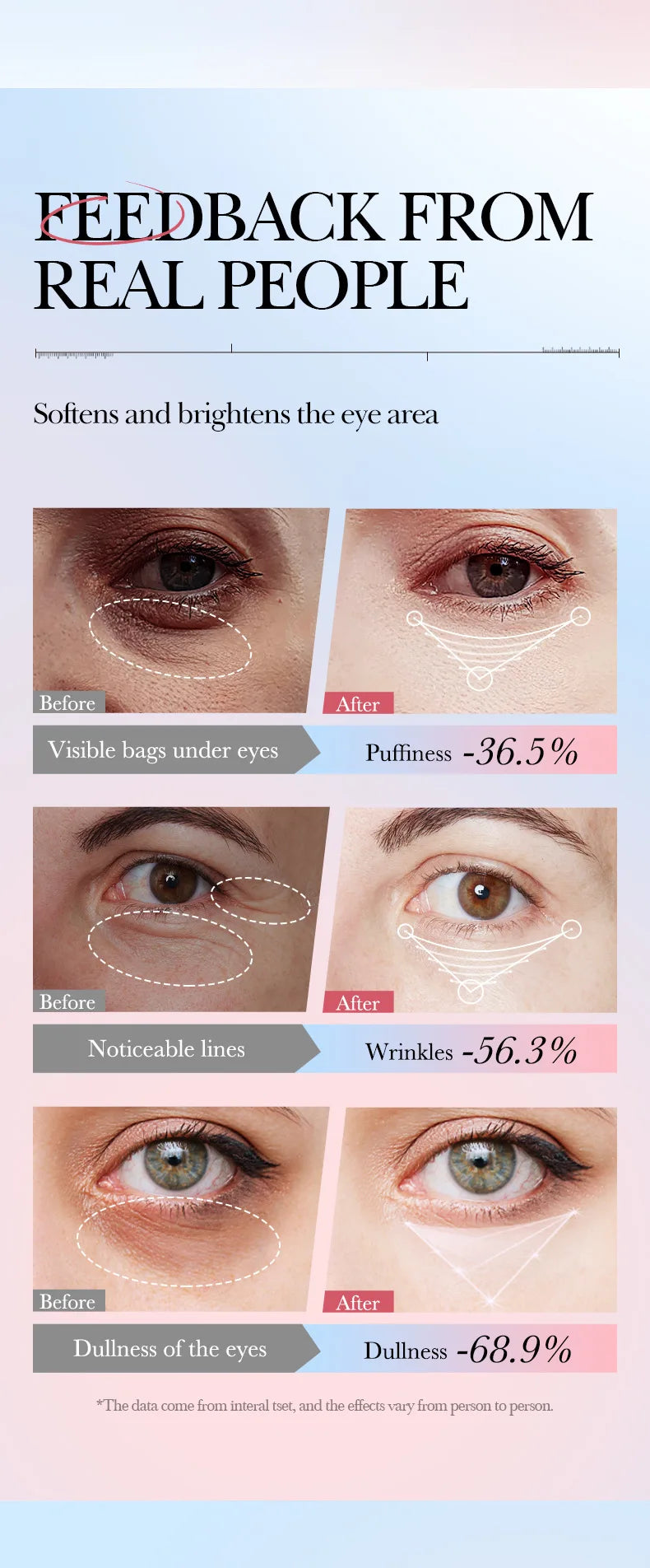 Instant Eye Bag Removal Cream Retinol Anti-Wrinkle Fade Fine Lines Firming Skin Anti Dark Circle Puffiness Brighten Eye Care