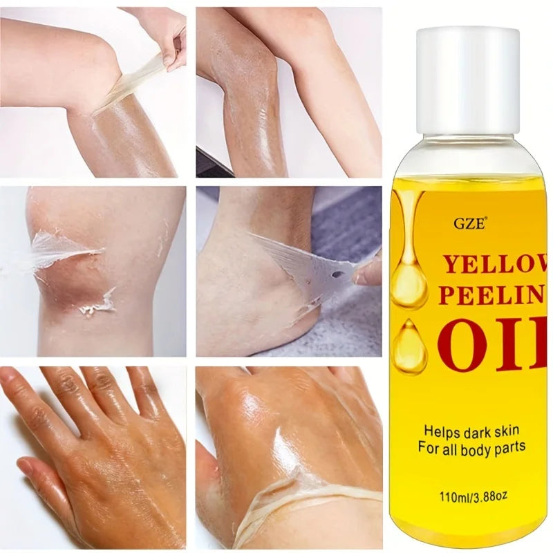 1PC Extra Strong Yellow Peeling Oil For Inner, Thighs, Body, Hand,Brightening Skin 110ml