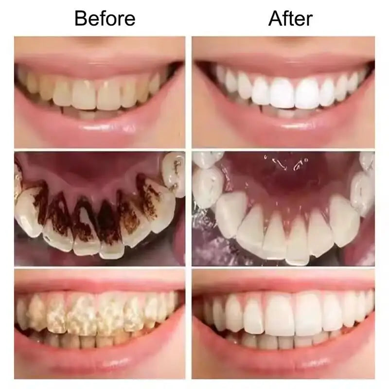 Teeth Whitening Essence Powder Clean Oral Hygiene Whiten Teeth Remove Plaque Stains Fresh Breath Oral Hygiene Dental Tools Set