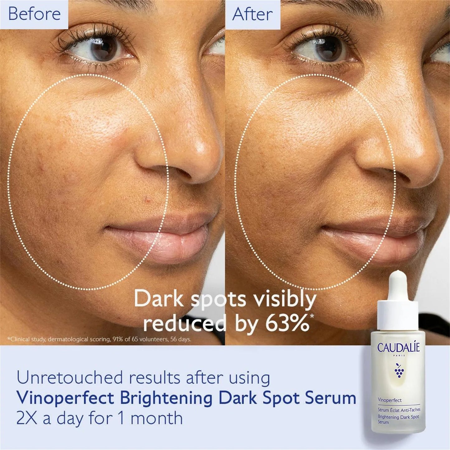 Brightening Dark, Moisturizing, Removing Dark And Brightening Even Skin Tone 30ml