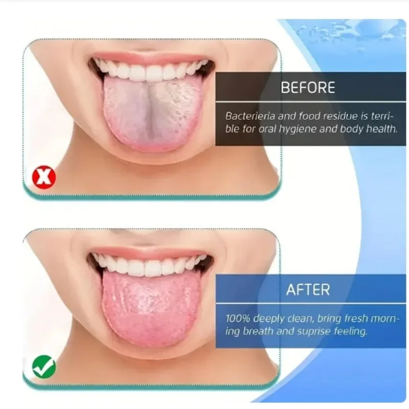 U Shape Tongue Scraper Oral Care Tools Stainless Steel Clean Mouth Clean Tongue Brush Bad Breath Tongue Tongue Cleaner