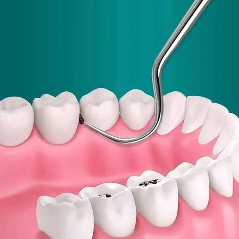 Portable Dental Tool Set Flossing Tooth Picking Tool Metal Stainless Steel Spiral Ear Pick Spoon Kit Oral Hygiene Tartar Removal