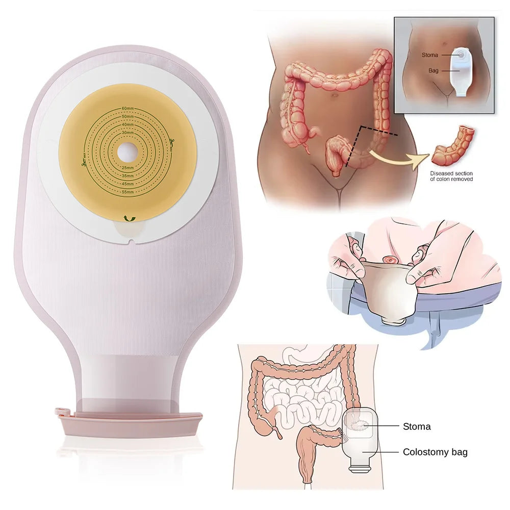 Cofoe 10pcs Ostomy Bags One-piece System Colostomy Bags  Disposable Colostomy Pouch Opening 20-60mm  With Clip Closure