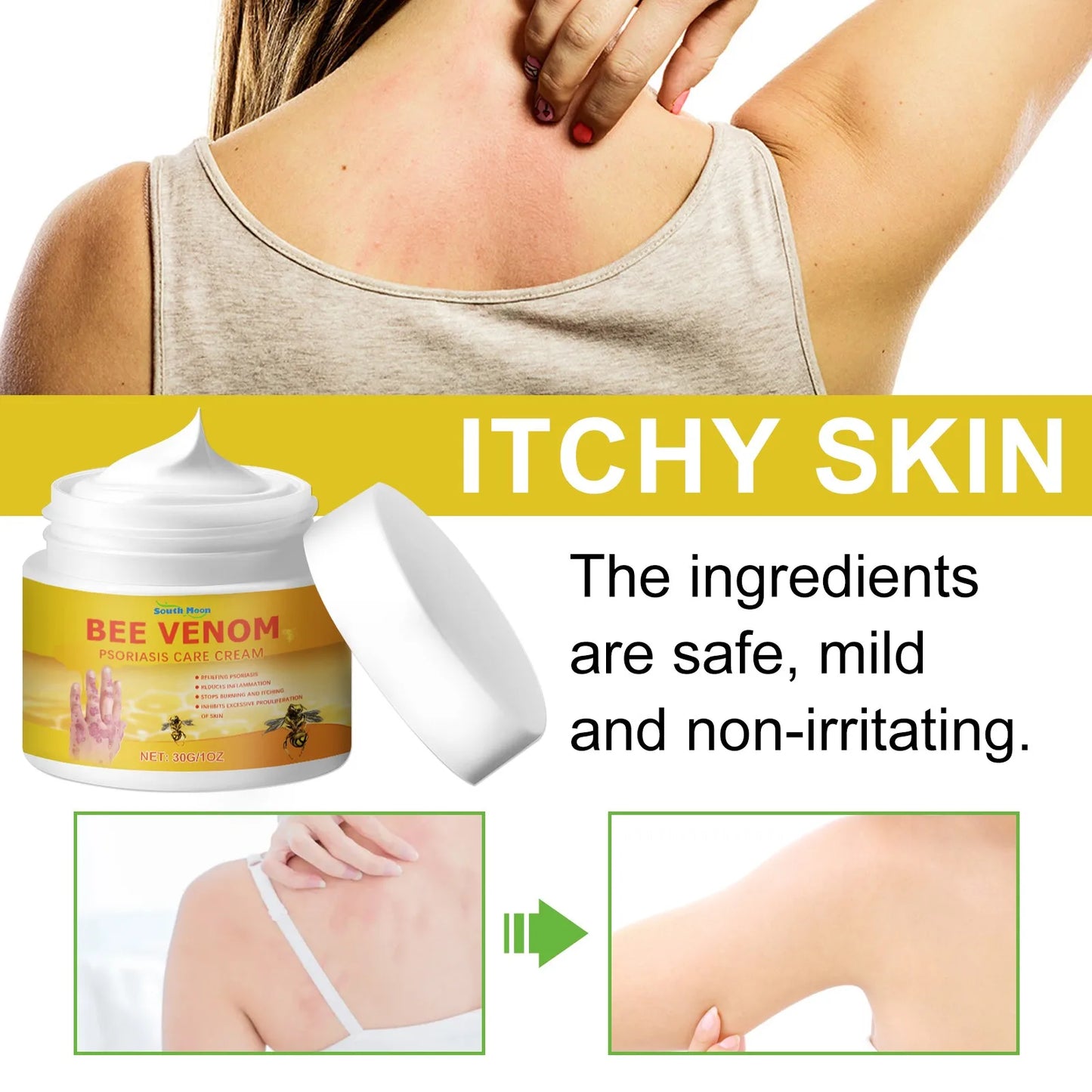 30ML Universal Natural Bee Venom relief cream, Hand And Foot Repaircream, Suitable For Neck, Waist, Back, Hands, Feet And Legs