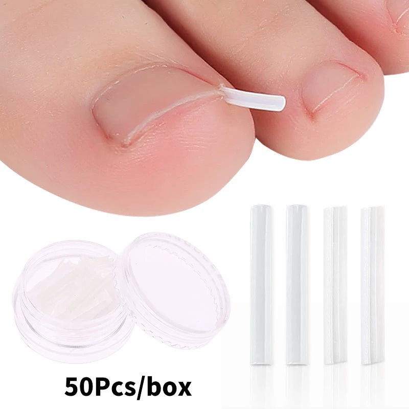 50Pcs/Box Ingrown Toenail Correction Strips Paronychia Correction Straightening Brace Toe Nail Treatment Groove Pedicure Tools