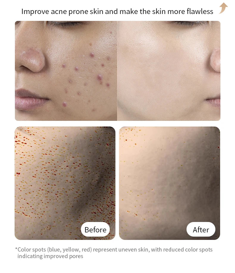 LED Facial Mask Red Light Therapy Photon Anti-Acne Wrinkle Removal Skin Rejuvenation Whitening Spa Mask Face Beauty Devices