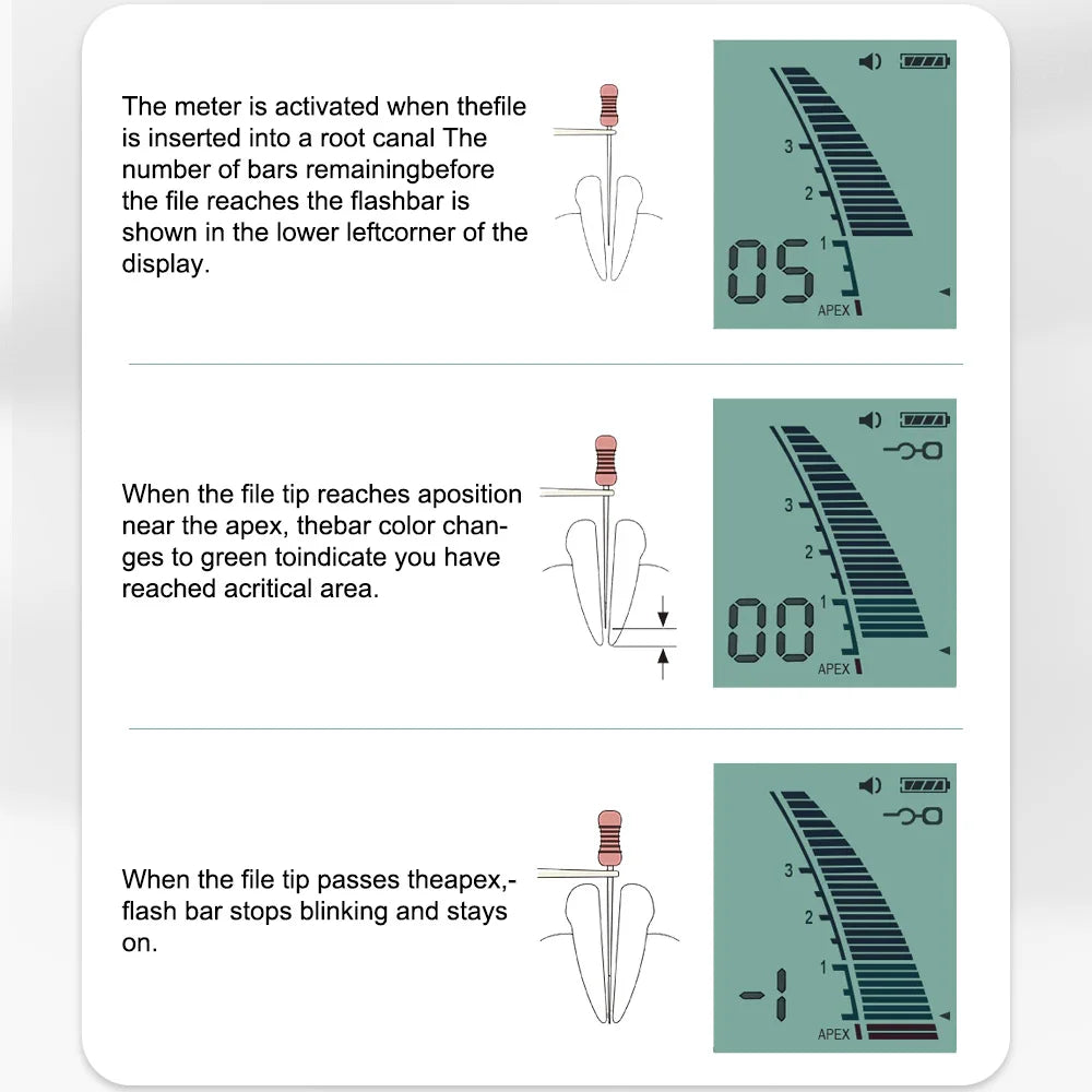 Mini Dental Endo Apex Locator Root Canal Measurement Endodontic Instrument ELIJAH Micropex Dentistry Root Canal Located Device