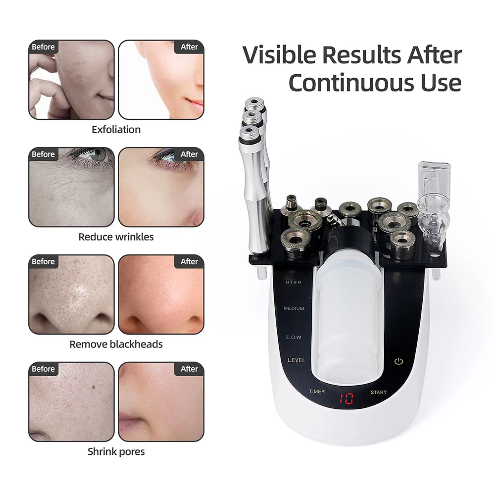 Home Use Facial Diamond Microdermabrasion Machine Face Peeling Beauty Machine Skin Exfoliation Pore Deep Cleaning SPA Skin Care