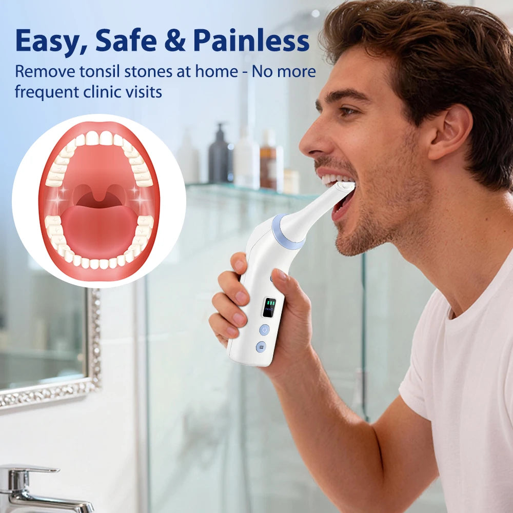 Portable Electric Tonsil Stone Remover Oral Irrigator with LED Light Oral Fresh Care for Tonsil Stones Removal Oral Care Tool