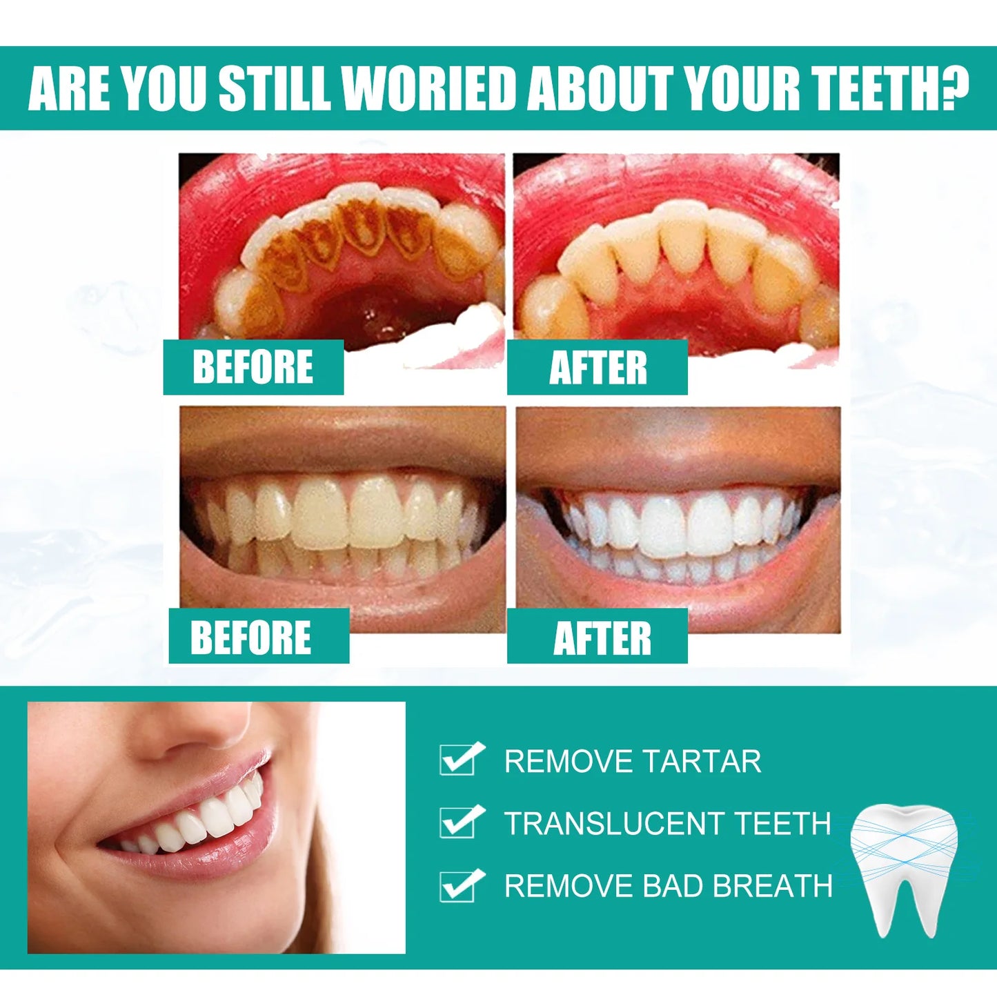 EELHOE Teeth Whitening Powder 5 Days Tooth Cleaning Oral Hygiene Care Plaque Stains Tartar Removal Stains Natural Cleaning Tool