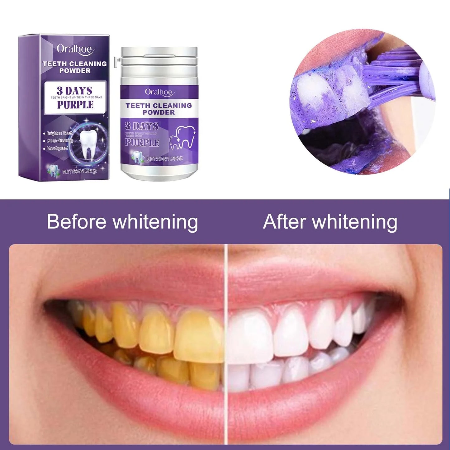 Teeth Whitening Powder Has A Whitening Effect, Which Is Effective For Deep Stains Tooth Whitening Care Product Healthy Gifts