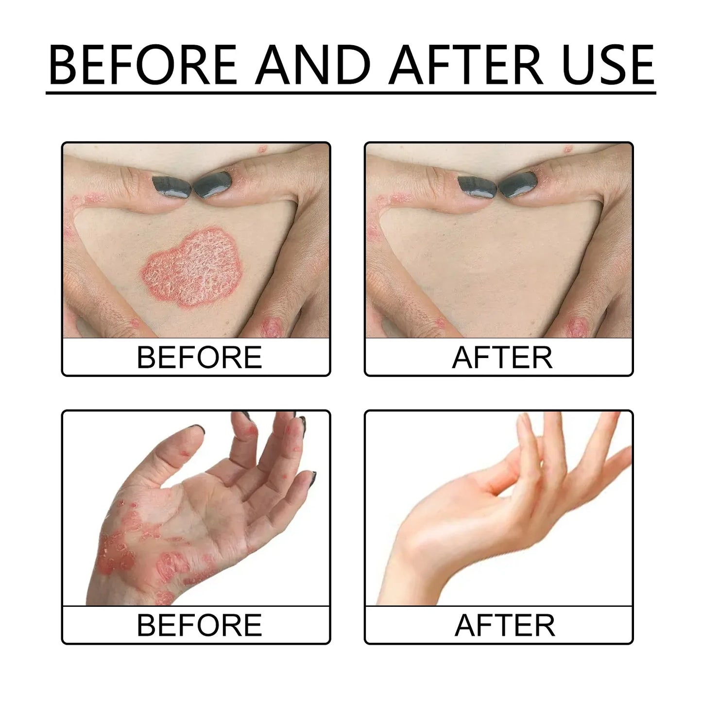30ML Universal Natural Bee Venom relief cream, Hand And Foot Repaircream, Suitable For Neck, Waist, Back, Hands, Feet And Legs