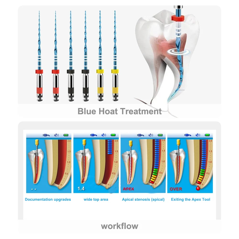 ELIJAH 6Pcs/Box 21/25/31mm Dental Reciprocating Blue Endodontic Files R25/40/50 Only One Engine Use Niti Rotary Root Canal File