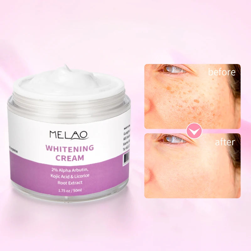 MELAO Whitening Cream Dark Skin Cream Moisturizing Brighten Face Underarm Armpit Knee Body Lotion