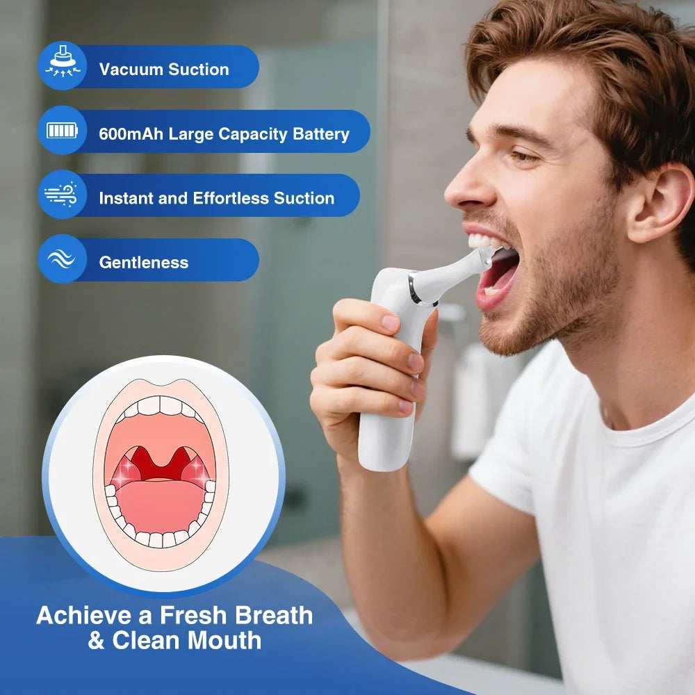 Electric Vacuum Tonsil Stone Removal Kit 3-Level Suction Fight Bad Breath Instant Suction Tonsil Cleaner with UV disinfection