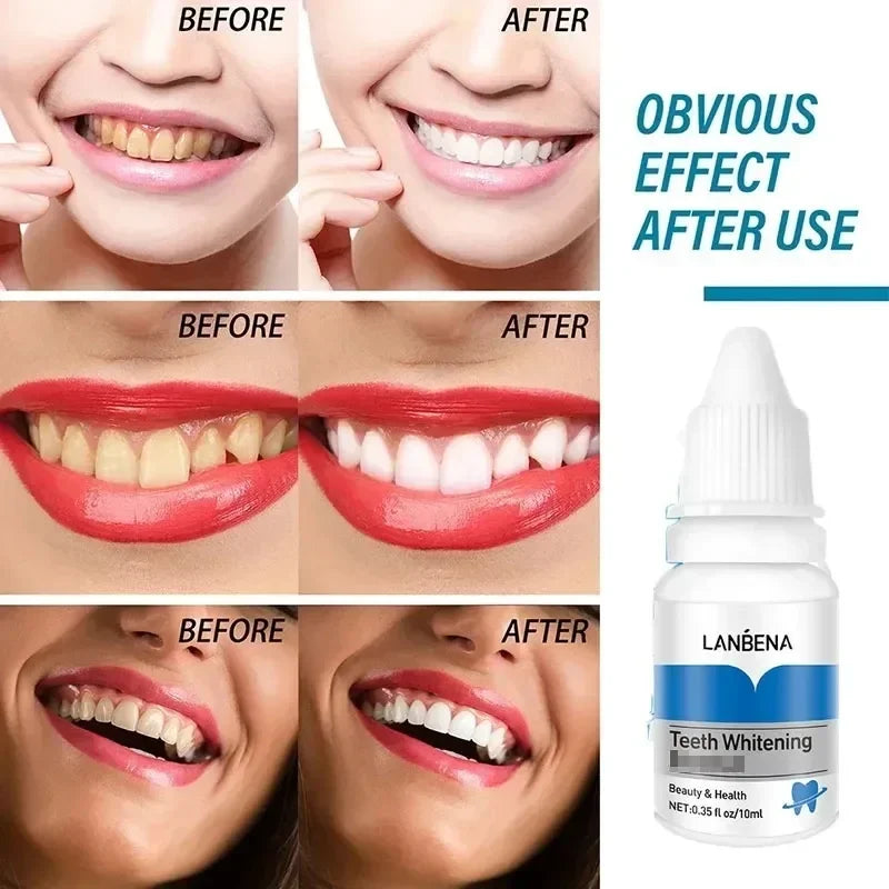 Teeth Whitening Essence Remove Against Dental Caries Plaque Stains Serum Fresh Breath Oral Hygiene Dental Tooth Cleaning Tools