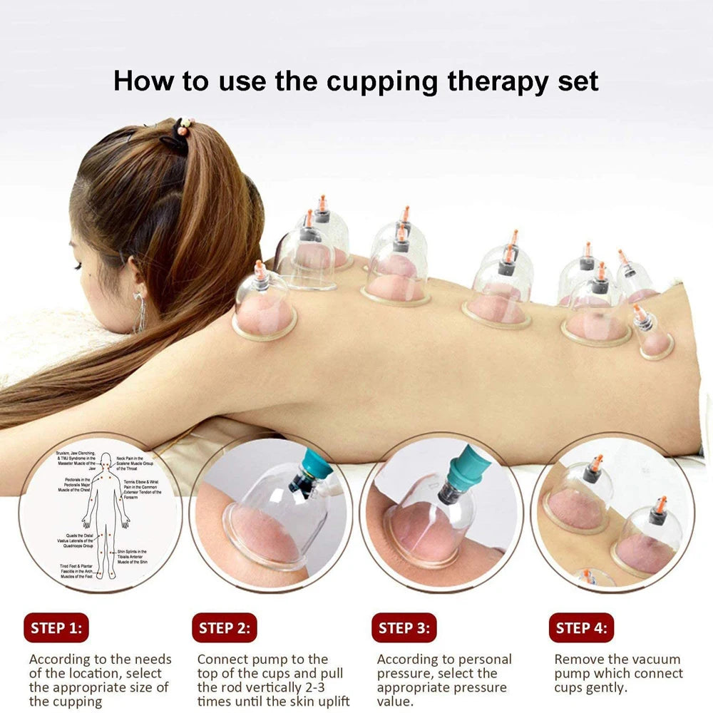 Cupping Therapy Sets,Hijama Cupping Vacuum Suction 24 Cups Sets for Cellulite Cupping Massage Back Pain Relief,Chinese Cupping
