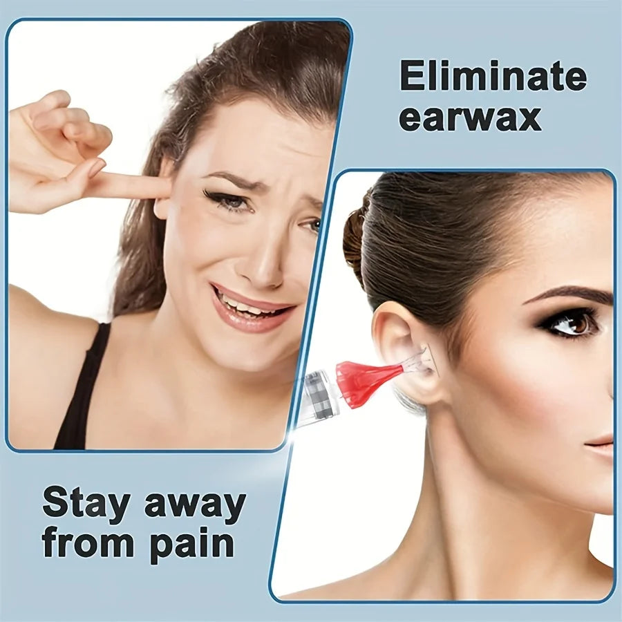 Ear Wax Removal Rinse Syringe Tool Kit with Ear Syringe Replacement Tip Nozzle, Ear Wax Remover Ear Cleaning Kit, Ear Cleaner Wa