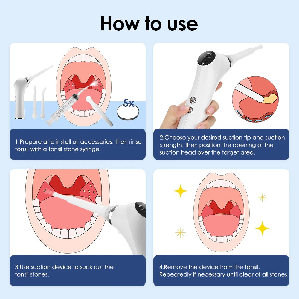Electric Tonsil Stone Remover Tonsil Stone Removal Kit Vacuum With Irrigation Syringe Instant Suction Tonsil Stone Removal