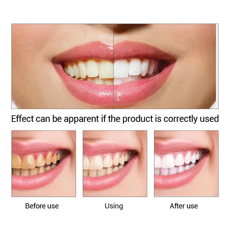 Teeth Whitening Essence Remove Against Dental Caries Plaque Stains Serum Fresh Breath Oral Hygiene Dental Tooth Cleaning Tools