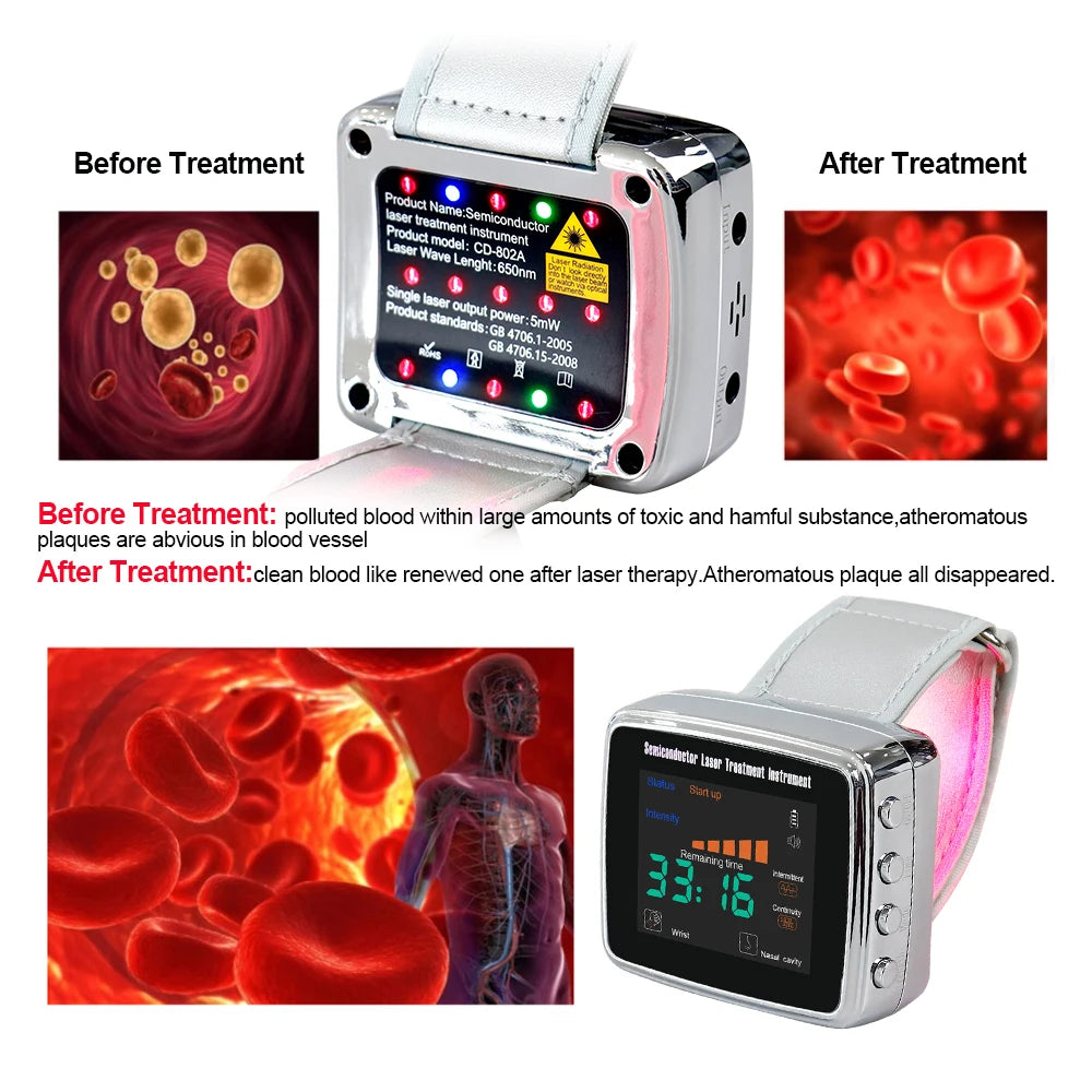 15 Laser 650nm Laser Therapy Wrist Watch LLLT for Diabetes Hypertension Cholesterol Treatment Laser Rhinitis Physiotherapy