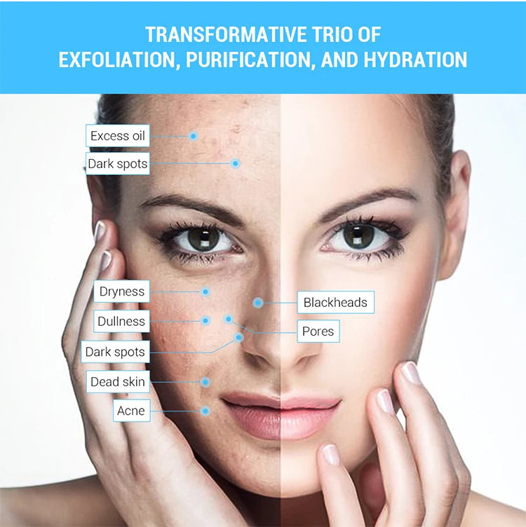 3 IN 1 Diamond Microdermabrasion hydra diamond Beauty Machine Water Spray Suction Blackhead Exfoliation Face Peeling Skin Tools
