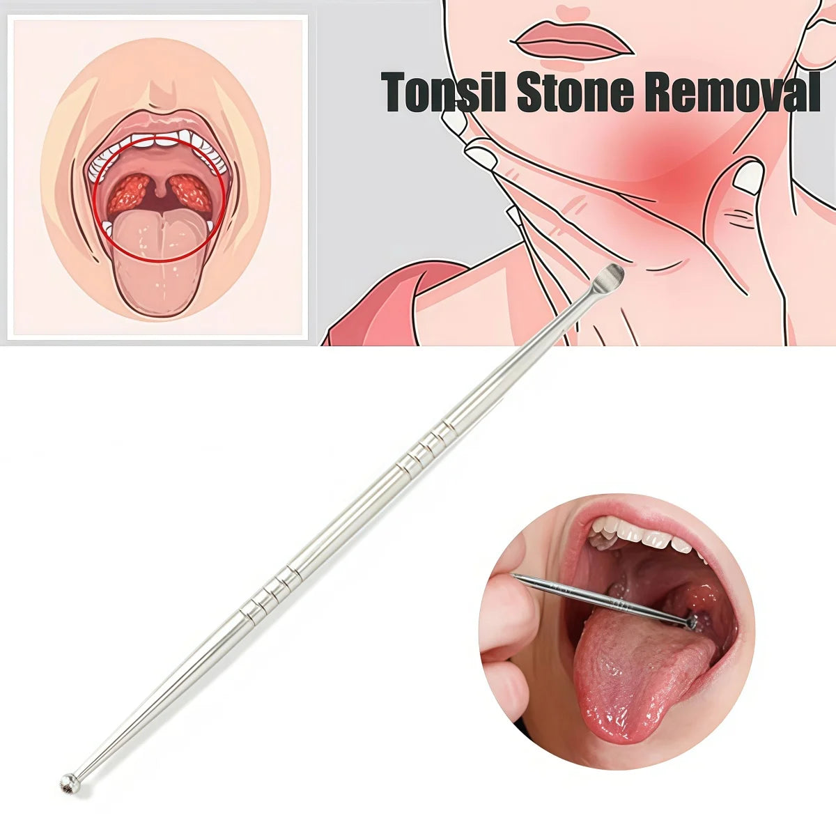 2/10pcs Tonsil Stone Removal Ear Wax Remover Tool Steel Remover Mouth Cleaning Care Tools Tonsil Stone Remover Health Care