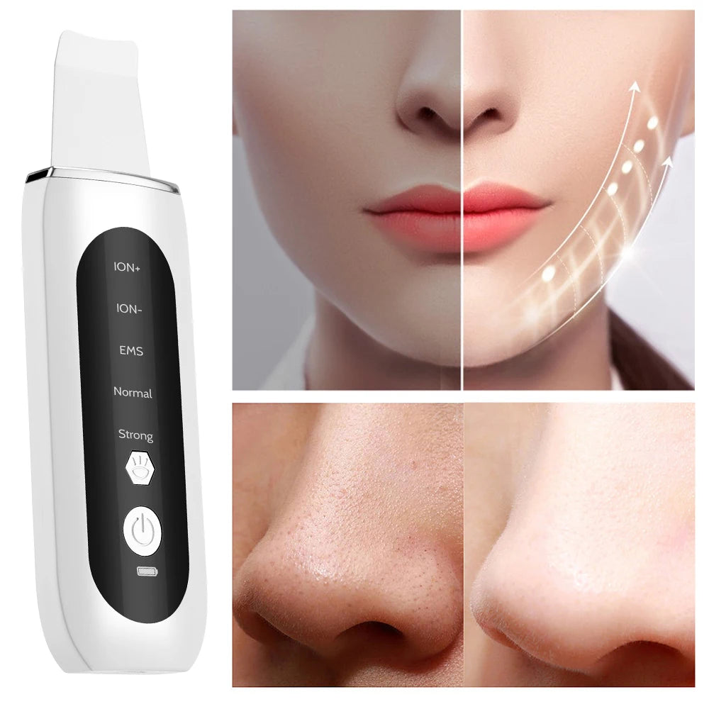 Ultrasonic Face Skin Scrubber Vibration Nose Deep Cleaning Machine   Facial Spatula Blackhead Remover Peeling Shovel Pore Clean
