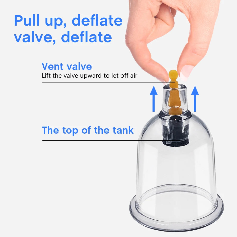 Chinese Medicine Suction Cups Anti Cellulite Electric Bank Vacuum Hijama Cupping Glasses Therapy Physiotherapy Massage Body Jars