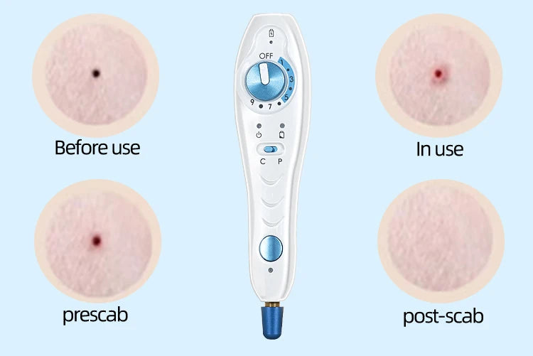 Portable Professional Plasma Pen Machine Removal Mole Wart Removing Pen Acne Treatment Beauty Machine Anti-Wrinkle Skin Lifting