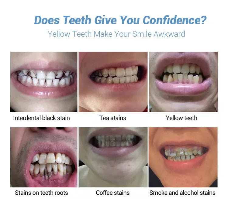 Teeth Whitening Essence Powder Clean Oral Hygiene Whiten Teeth Remove Plaque Stains Fresh Breath Oral Hygiene Dental Tools Set