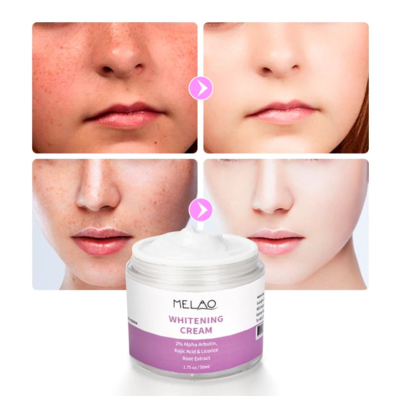 MELAO Whitening Cream Dark Skin Cream Moisturizing Brighten Face Underarm Armpit Knee Body Lotion