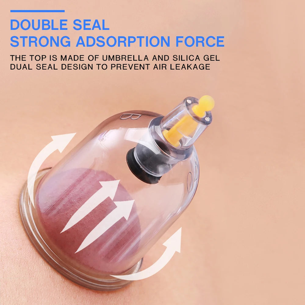 Chinese Medicine Suction Cups Anti Cellulite Electric Bank Vacuum Hijama Cupping Glasses Therapy Physiotherapy Massage Body Jars