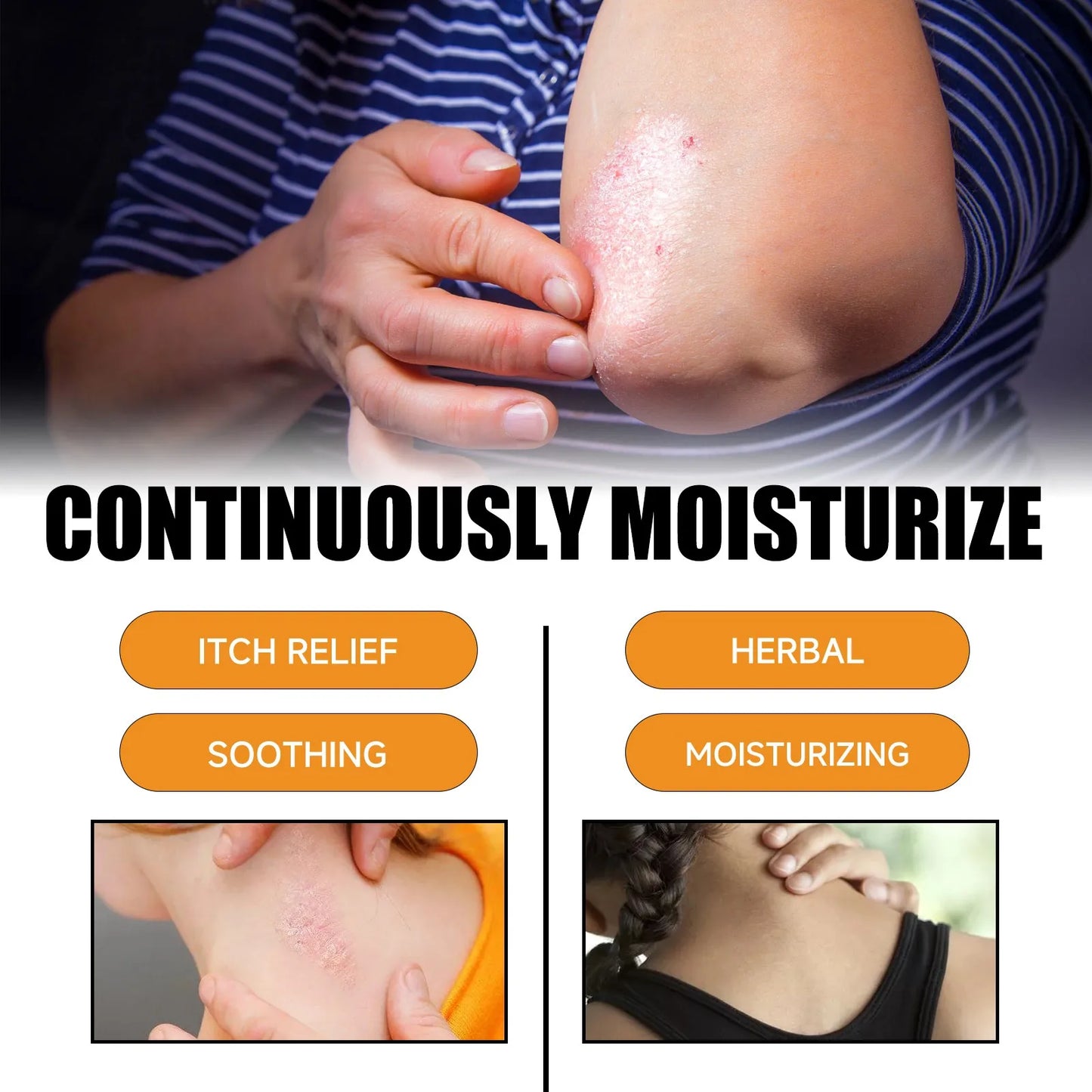 30ML Universal Natural Bee Venom relief cream, Hand And Foot Repaircream, Suitable For Neck, Waist, Back, Hands, Feet And Legs