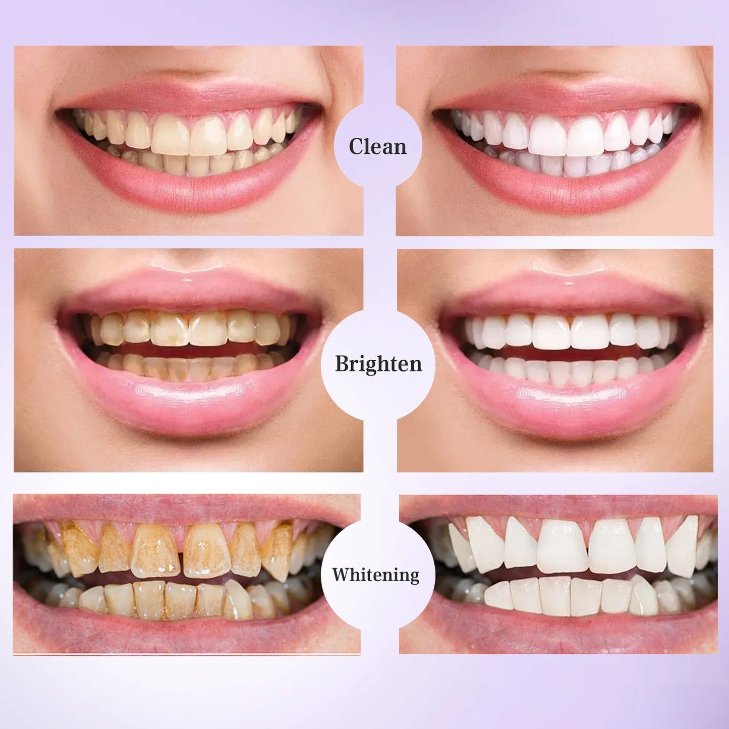 5D Whitening Teeth Stickers 7/14 Pairs Gel Whitening Strips Stain Removal Oral Hygiene Care Strip Dental Bleaching Tools Teeth