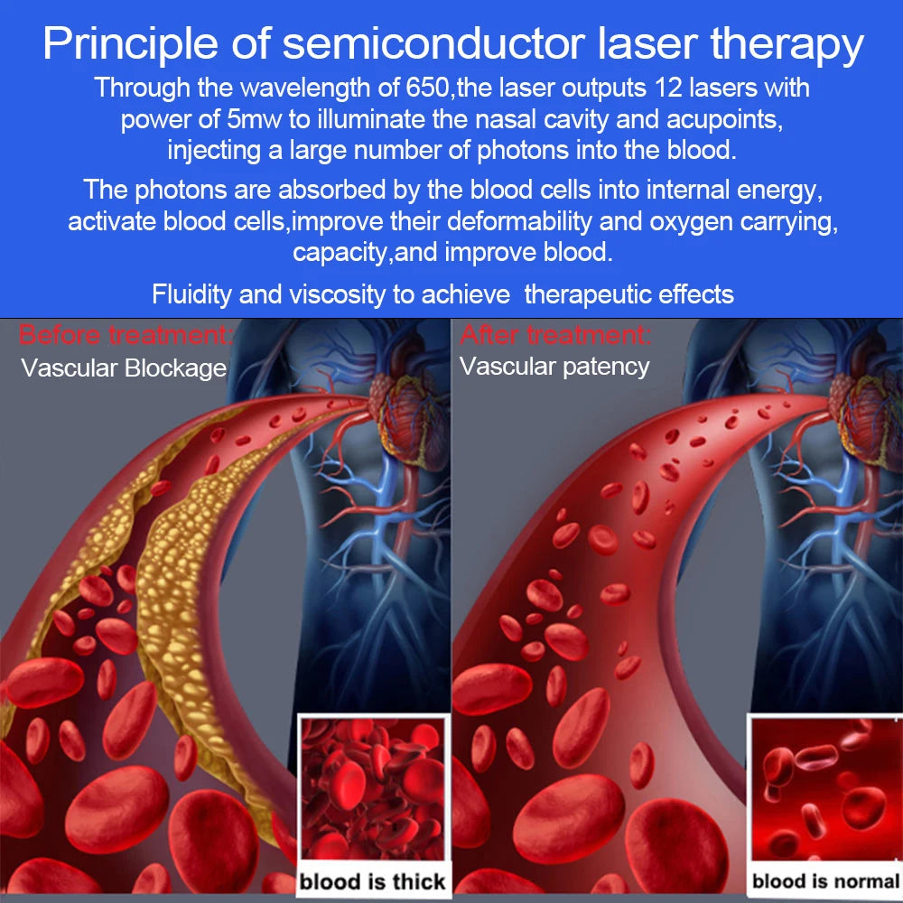 15 Laser 650nm Laser Therapy Wrist Watch LLLT for Diabetes Hypertension Cholesterol Treatment Laser Rhinitis Physiotherapy