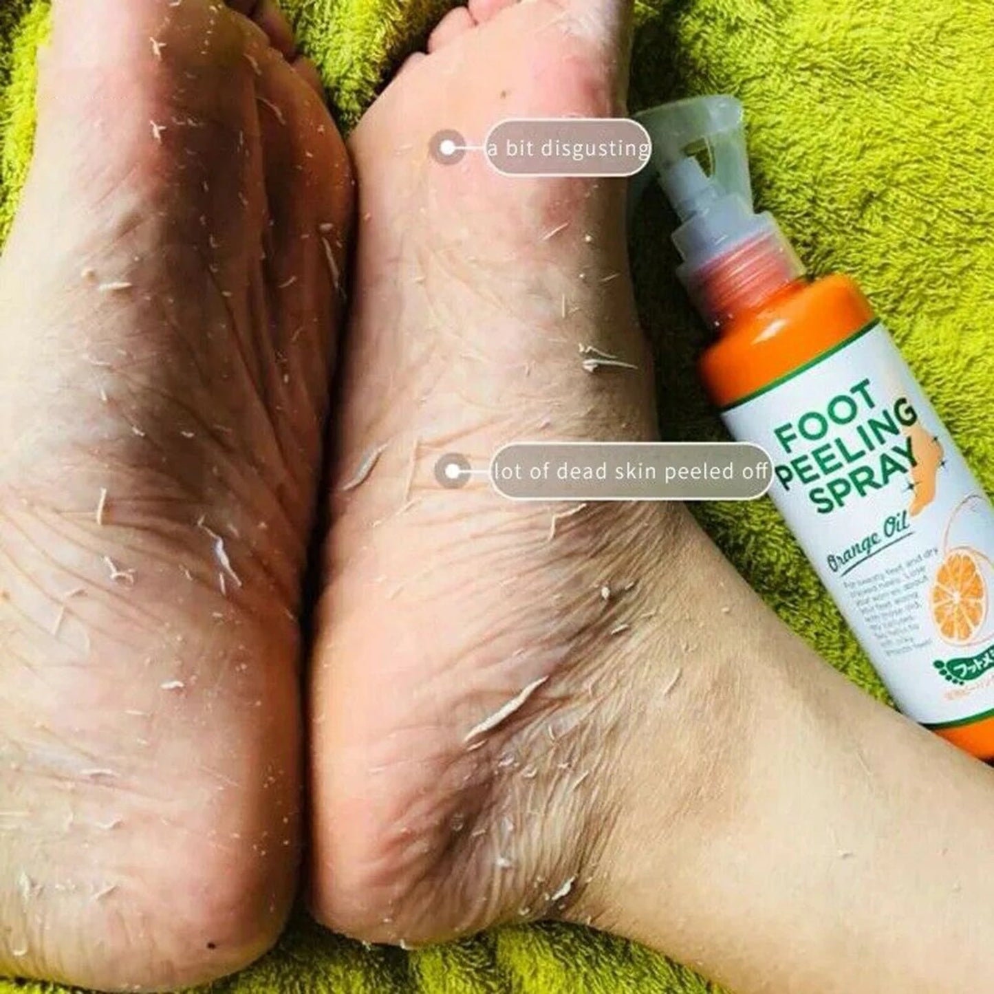 110ML Foot Peeling Spray  Improve Rough Skin Available For Whole Body