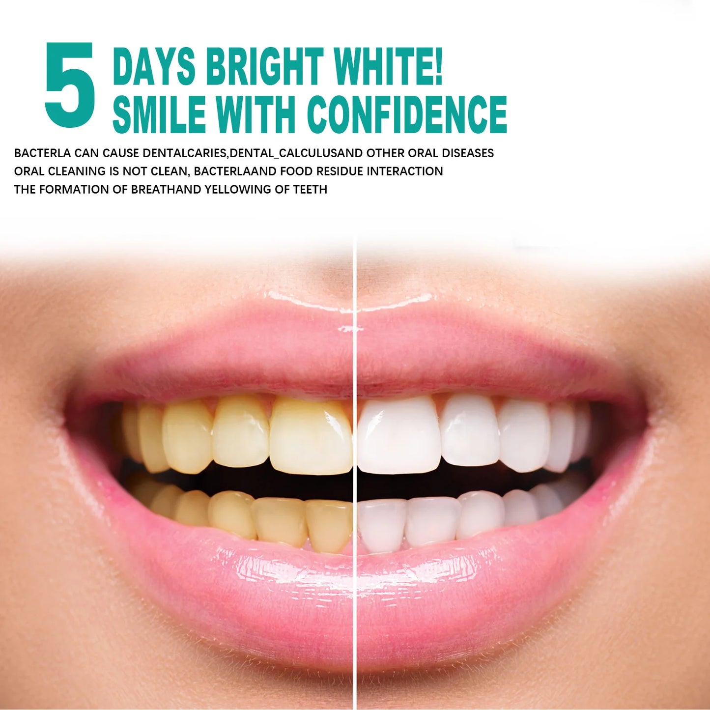 EELHOE Teeth Whitening Powder 5 Days Tooth Cleaning Oral Hygiene Care Plaque Stains Tartar Removal Stains Natural Cleaning Tool