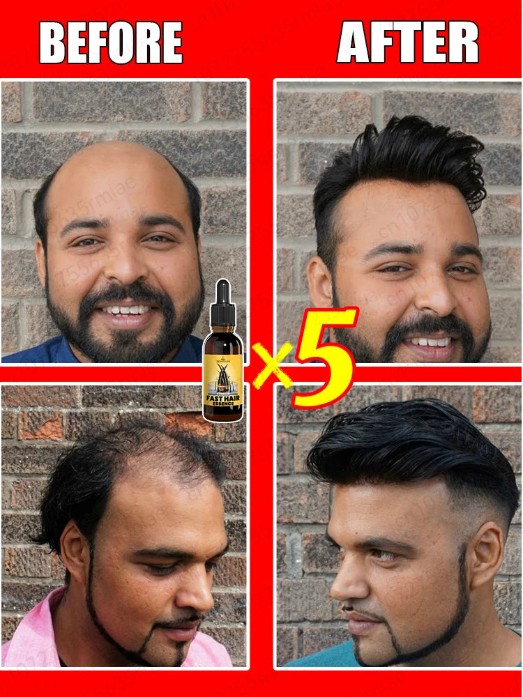 Do you want to say goodbye to hair loss? Our products can penetrate the hair follicles and help your hair regenerate