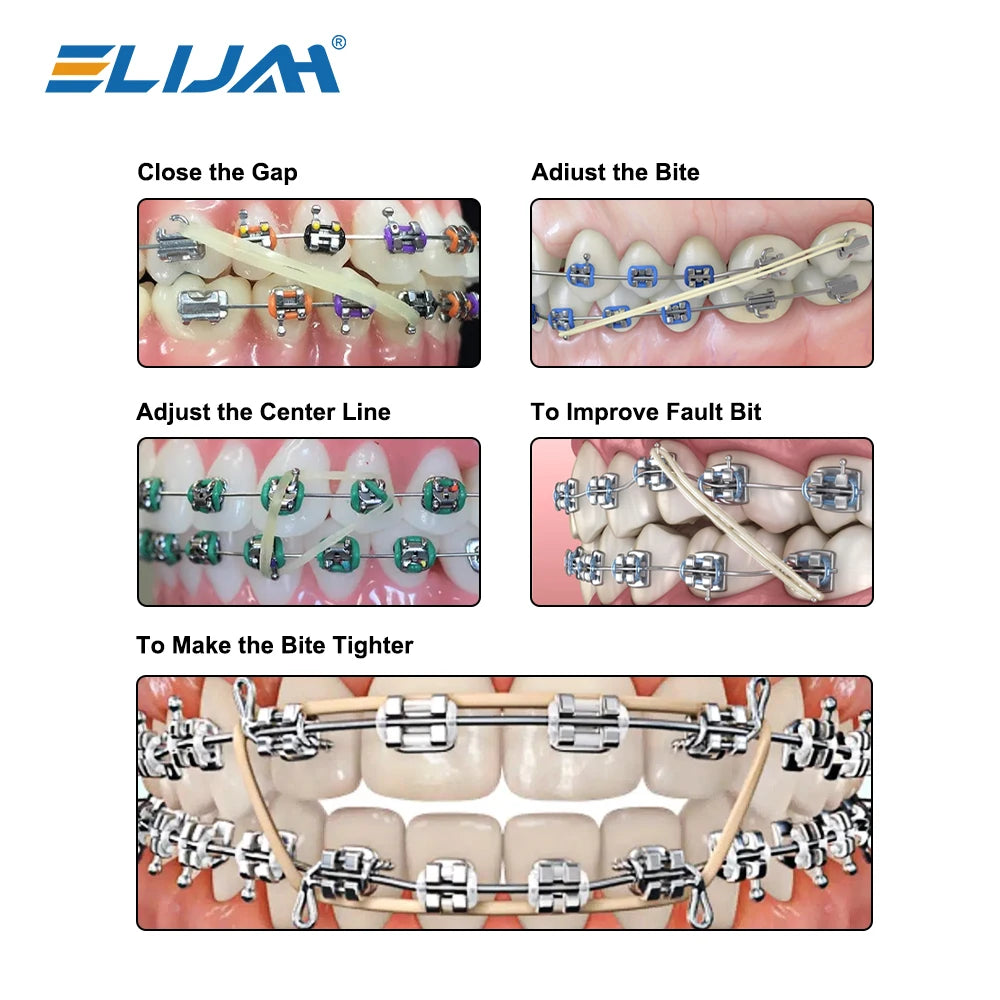 5000Pcs Dental Rubber Band Orthodontic Ligation O-Ring  Animal Traction Rings Fox Chipmunk Rabbit Orthodontics Braces Elastics