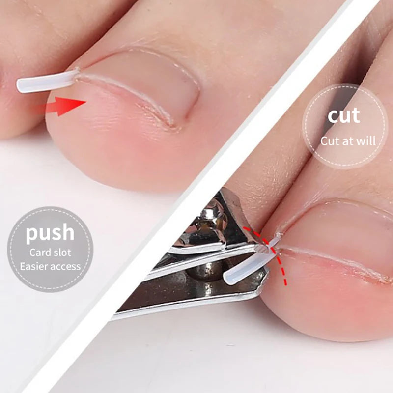 50Pcs/Box Ingrown Toenail Correction Strips Paronychia Correction Straightening Brace Toe Nail Treatment Groove Pedicure Tools