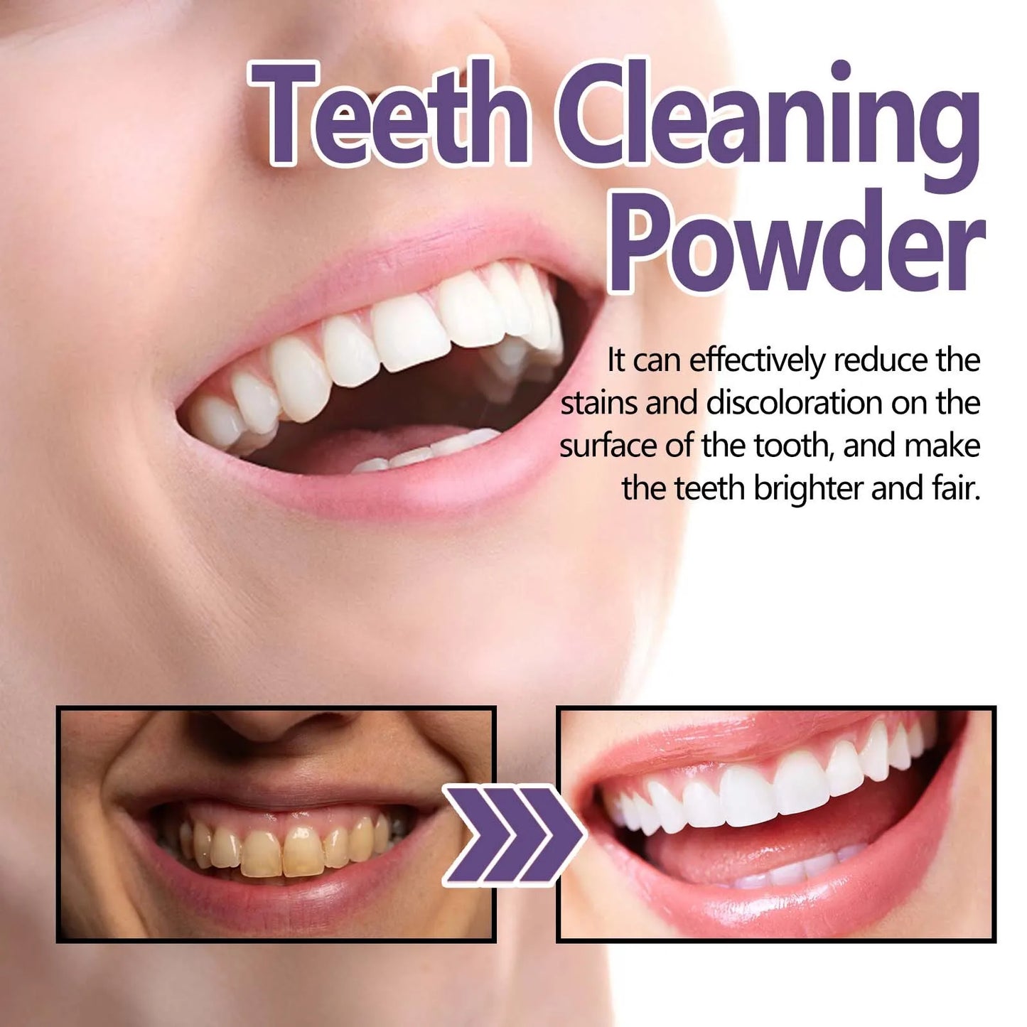 Teeth Whitening Powder Has A Whitening Effect, Which Is Effective For Deep Stains Tooth Whitening Care Product Healthy Gifts