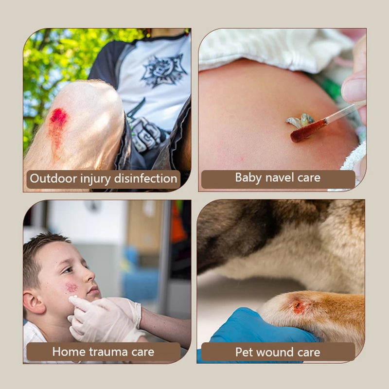 50PCS/Lot Medical Alcohol Disposable Emergency Cotton Stick Iodine Disinfected Swab First Aid For Children Adults Baby