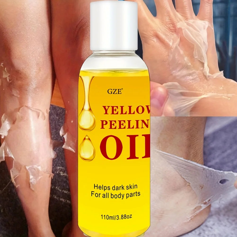 1PC Extra Strong Yellow Peeling Oil For Inner, Thighs, Body, Hand,Brightening Skin 110ml