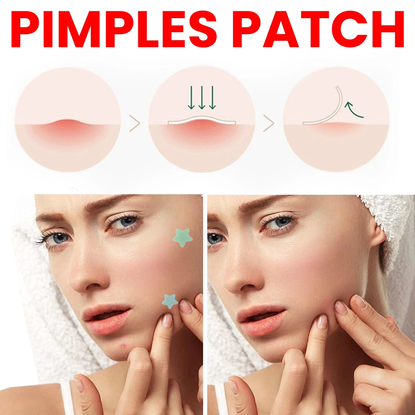 200Pcs Repair Acne Patch Fade Blemishes Pimple Marks Closed Acne Blemishes Hydrocolloid Star Shaped Cover Acne Pimple Patch