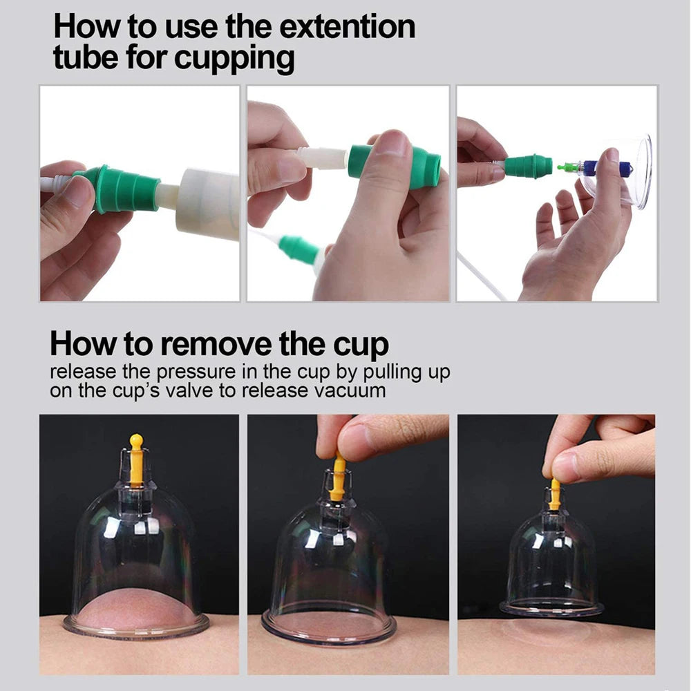 Cupping Therapy Sets,Hijama Cupping Vacuum Suction 24 Cups Sets for Cellulite Cupping Massage Back Pain Relief,Chinese Cupping