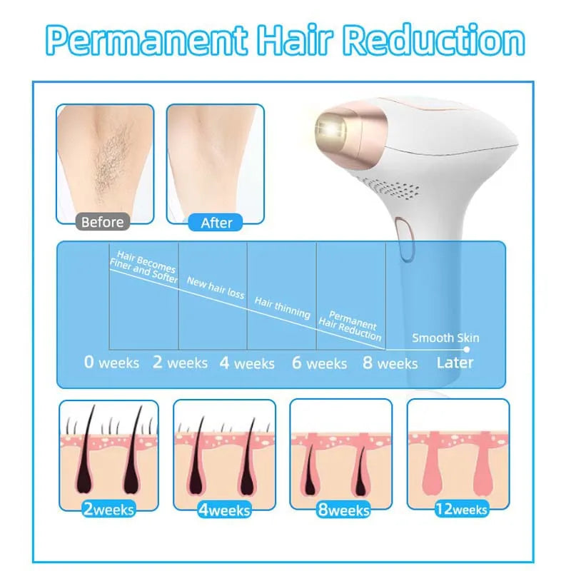 3-in-1 ABS Material Light Hair Removal Instrument Intense Pulse IPL Photon Beauty Tender Skin Removal Wholesale Ice Gratitude